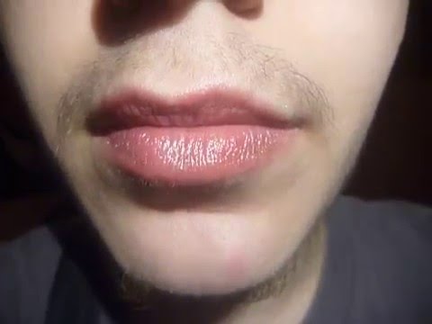 Aquí us deixem el comunicar de Joves Trans davant l·emissió del programa 30minuts de TV3, ·Trànsit, menors transsexuals· que invisibilitza la diversitat del col·lectiu trans, excloent-nos a moltes de nosaltres de l·imaginari social, cosa que pot repercutir negativament a les nostres vides.Comunicat escrit: Quantes vegades ens deuen haver dit emocionades a les persones que estem a JTB que faran un 30 minuts sobre transsexualitat?Ja ho sabem. Aquest programa ens va entrevistar a Joves Trans de Barcelona, però no hi sortirem. Hi havia massa poc temps i òbviament de tots els més de 30minuts no en pot haver-hi ni un que qüestioni el sistema de gènere.Aquest programa, com la majoria que surten als mitjans, només vol mostrar aquella part que podria ser assimilada pel sistema. Es mostra aquelles vivències que són normatives en quasi tot menys el tema que es tracta (ser trans), per tal de poder acceptar aquest. I això fa que ·s·oblidi· que hi ha persones trans que no volem o podem hormonar-nos, que hi ha trans que no som heteros, que hi ha trans que no som homes o dones, que hi ha trans que no sempre ens identifiquem de la mateixa manera, que hi ha trans que no tenim la capacitat i/o volem aguantar que ens diguin des de fora si som trans o no, i un llarg etc.Aquest ·oblit· sistemàtic reforça que només hi ha una forma de ser trans/de ser trans real/o més trans. Això, genera una jerarquia que legitima que s·accepti a qui està a dalt però que ens exclou a totes les altres. Així es posa la barrera de la norma una mica més enllà, acceptant allò que queda més a prop de la norma, però sense qüestionar-la.No és un oblit, no és casual, és de nou una violència cap a nosaltres, cap a totes aquelles que no encaixem a la seva nova norma perquè la nostra existència la trenca. I a sobre se·ns demana que estiguem contentes perquè com a mínim es parla del ·nostre· tema, que com veieu, de nostre en té poc.Hem d·estar contentes que es mostri la mateixa norma que ens exclou? La normativitat trans, aquella que jerarquitza, que és classista, que és cissexista, que és dualista, capacitista...: - Que jerarquitza perquè decideix qui és més o menys trans o fins i tot qui és trans de veritat. - Que és classista perquè ignora aquelles que no podem pagar certs processos o serveis professionals o que no tenim estudis o feina. - Que és cissexista perquè assumeix que hem de voler aquests processos per semblar cisgènere, per a simple vista encaixar dins el sistema de gènere. - Que és dualista perquè no contempla res més enllà de ser home o dona. - Que és capacitista pel discurs constant de ·som normals·, també en relació a la salut mental, ignorant i rebutjant aquelles que tenim depressió, trastorn límit de la personalitat, bipolaritat... perquè donem mala imatge. - I moltes altres coses que podríem haver explicat en el 30 minuts si no ens haguessin censurat. Hem d·estar contentes que durant els pocs minuts que es parla d·allò trans, hi hagi cisgèneres (persones no trans, que s·identifiquen amb el gènere que se·ls va assignar al néixer) ocupant l·espai parlant de com de dur va ser acceptar tenir una criatura trans? No ho estem. I menys encara quan això fa que s·exclogui persones trans. Quan això ens fa literalment fora dels mitjans de comunicació i ens nega la possibilitat de poder explicar la nostra realitat fent que l·expliqui algú que no ho viu en primera persona. Quan això fa que la gent a casa empatitzi més amb la persona cis que amb la trans. Quan això fa que se li tirin medalles a persones cis per alguna cosa tan bàsica com no negar la identitat a les seves criatures. Per tot això, el que es mostra en el 30 minuts representa tot allò contra el que lluitem i per això volem visibilitzar tot el que aquest programa ha ocultat.(Si teniu qualsevol dubte ho podeu preguntar a comentaris).https://www.youtube.com/watch?v=fyjlJmaFCHY